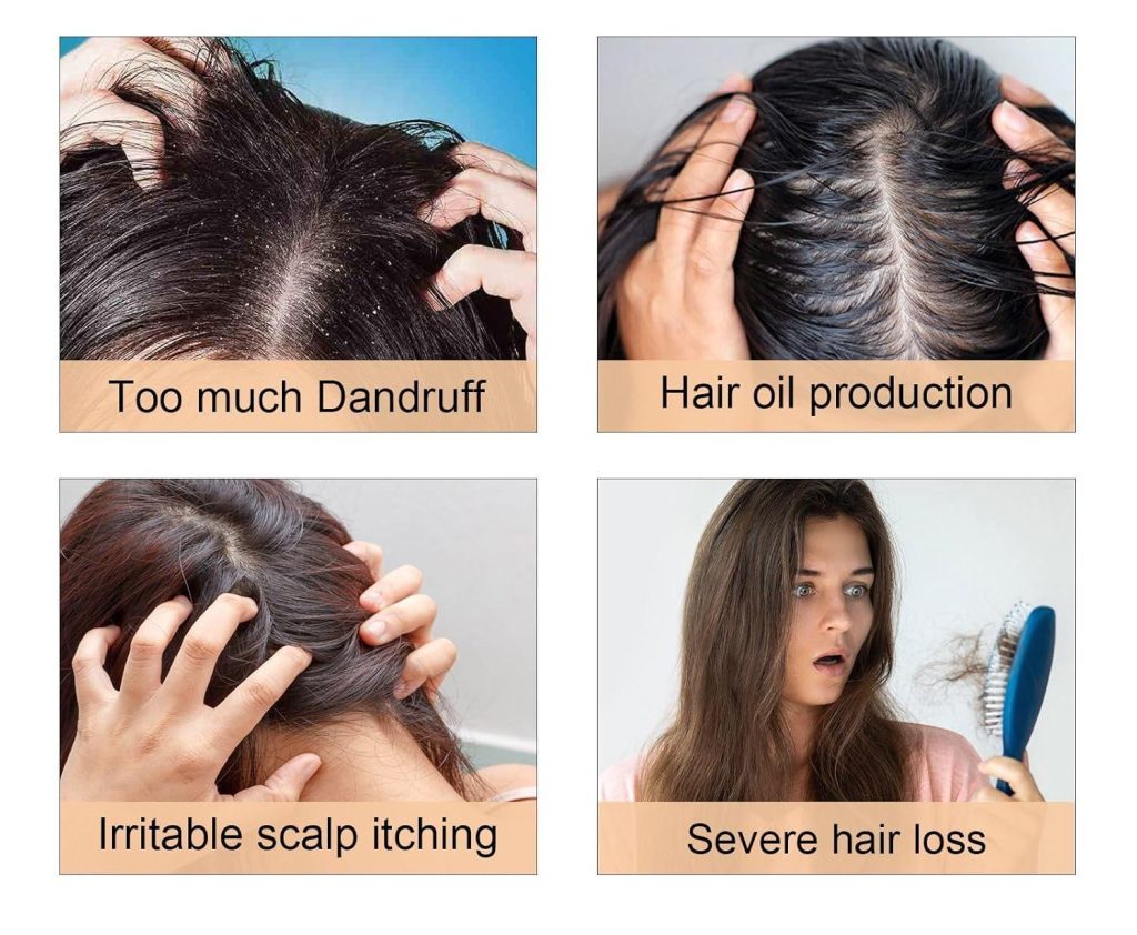 اسکراب اسکالپ کف سر